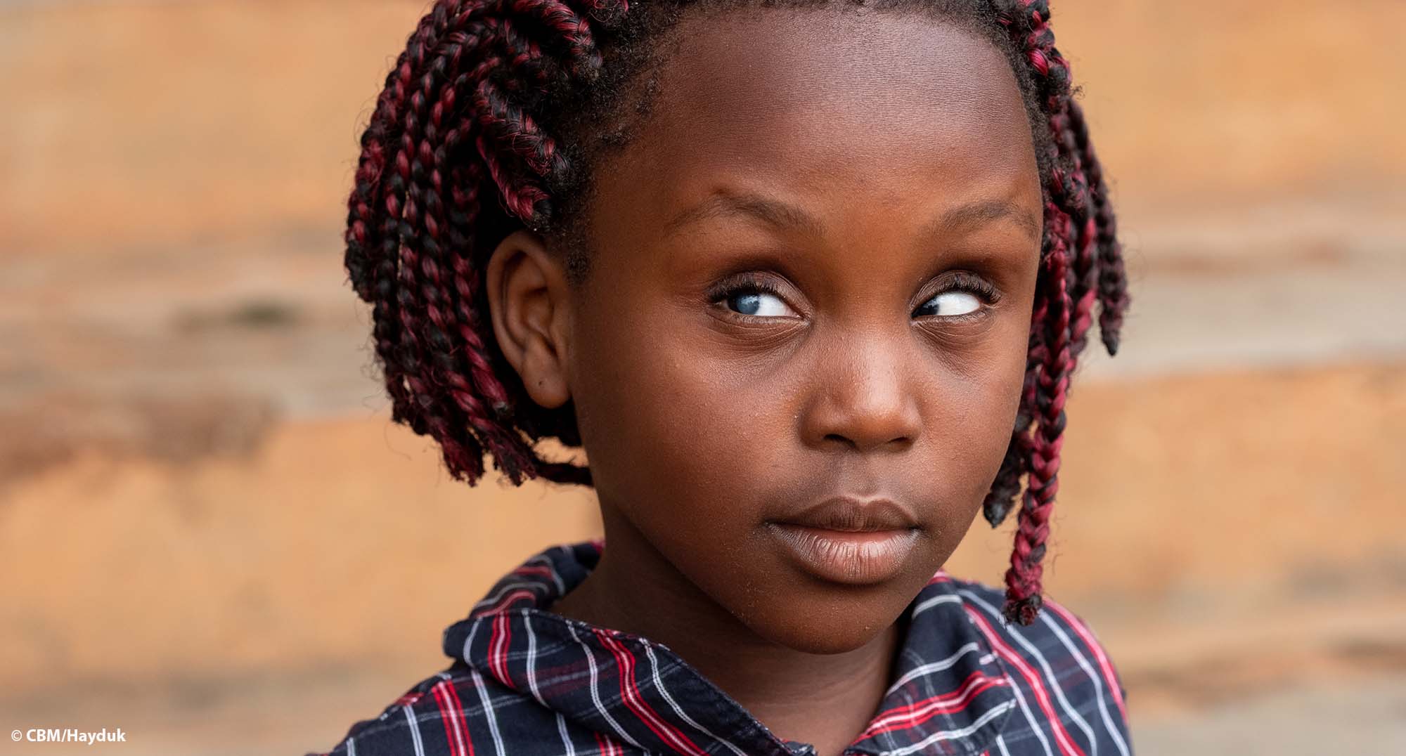 Porträt eines Mädchens aus Uganda, das im einen Auge Grauen Star und im anderen unwillkürliche Augenbewegungen hat.
