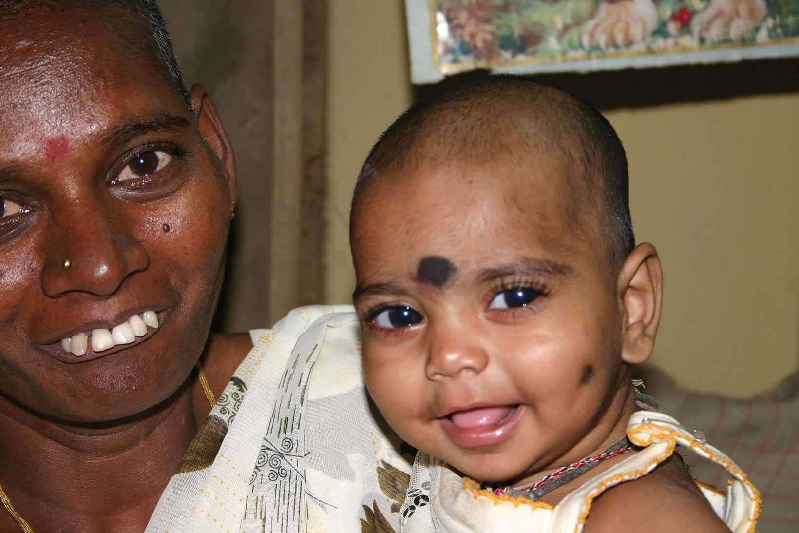 Una madre ha in braccio il suo bambino: Uno dei molti bambini che grazie alla CBM non è più ipovedente.