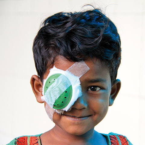 Opération cataracte enfants