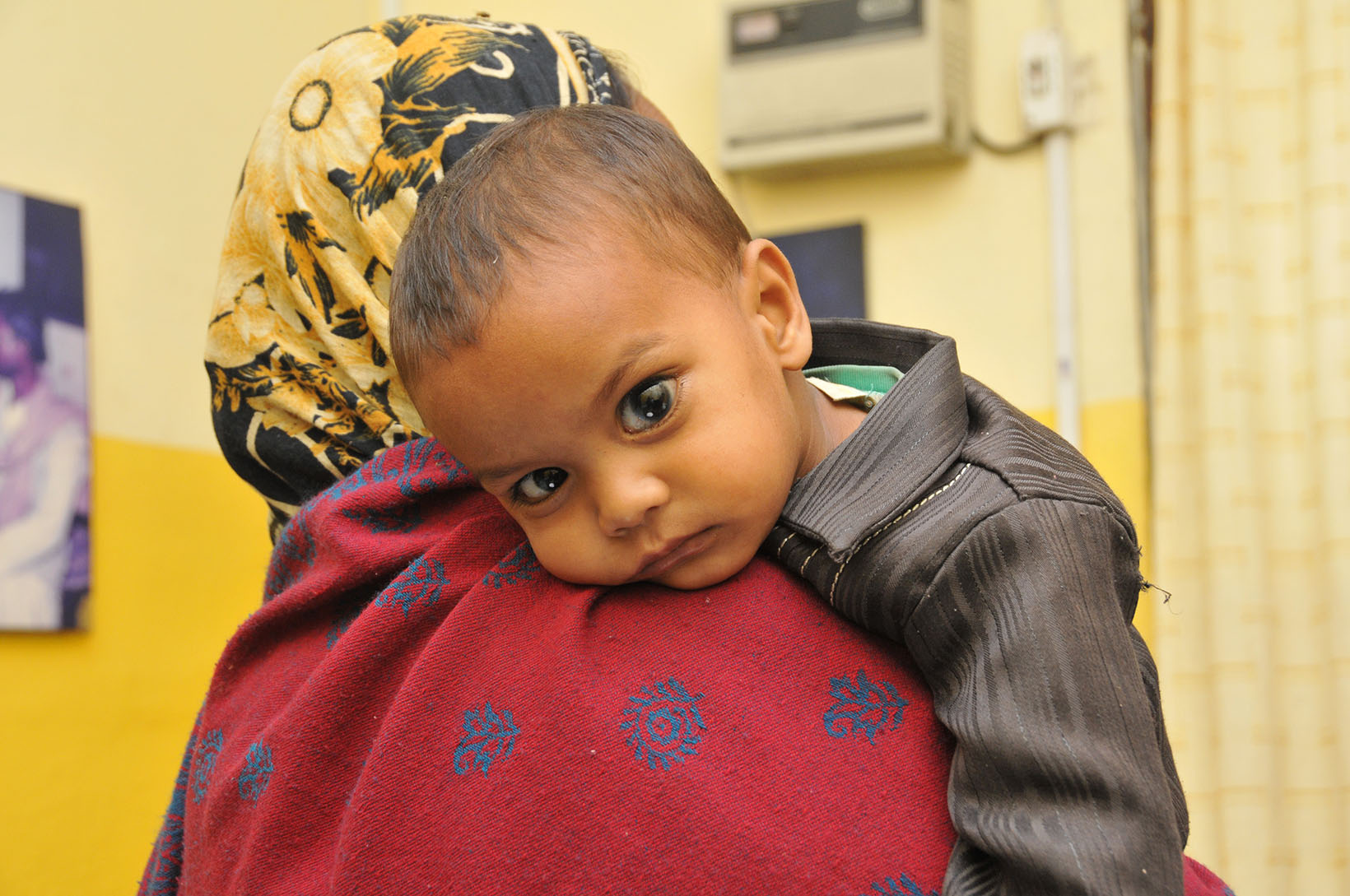 Un neonato colpito dal glaucoma in braccio ad una donna. 