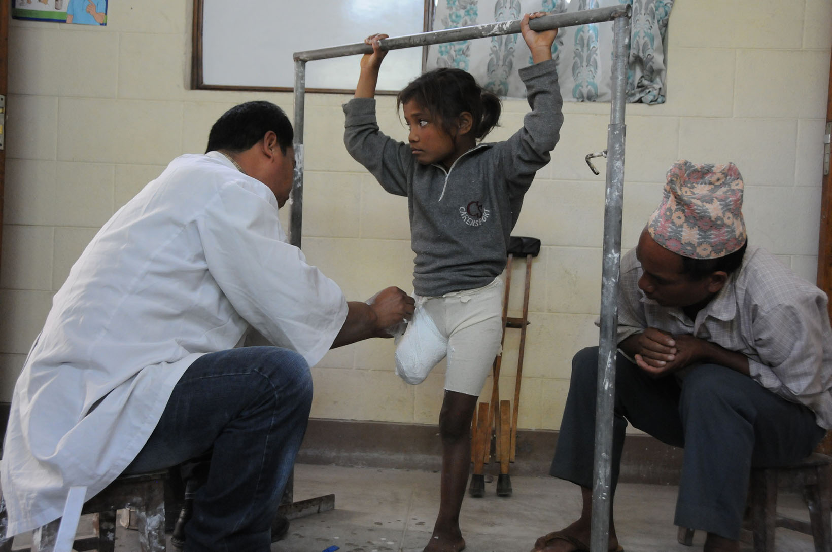 Ein Arzt stellt ein Gipsnegativ des Stumpfes eines nepalischen Mädchen her.