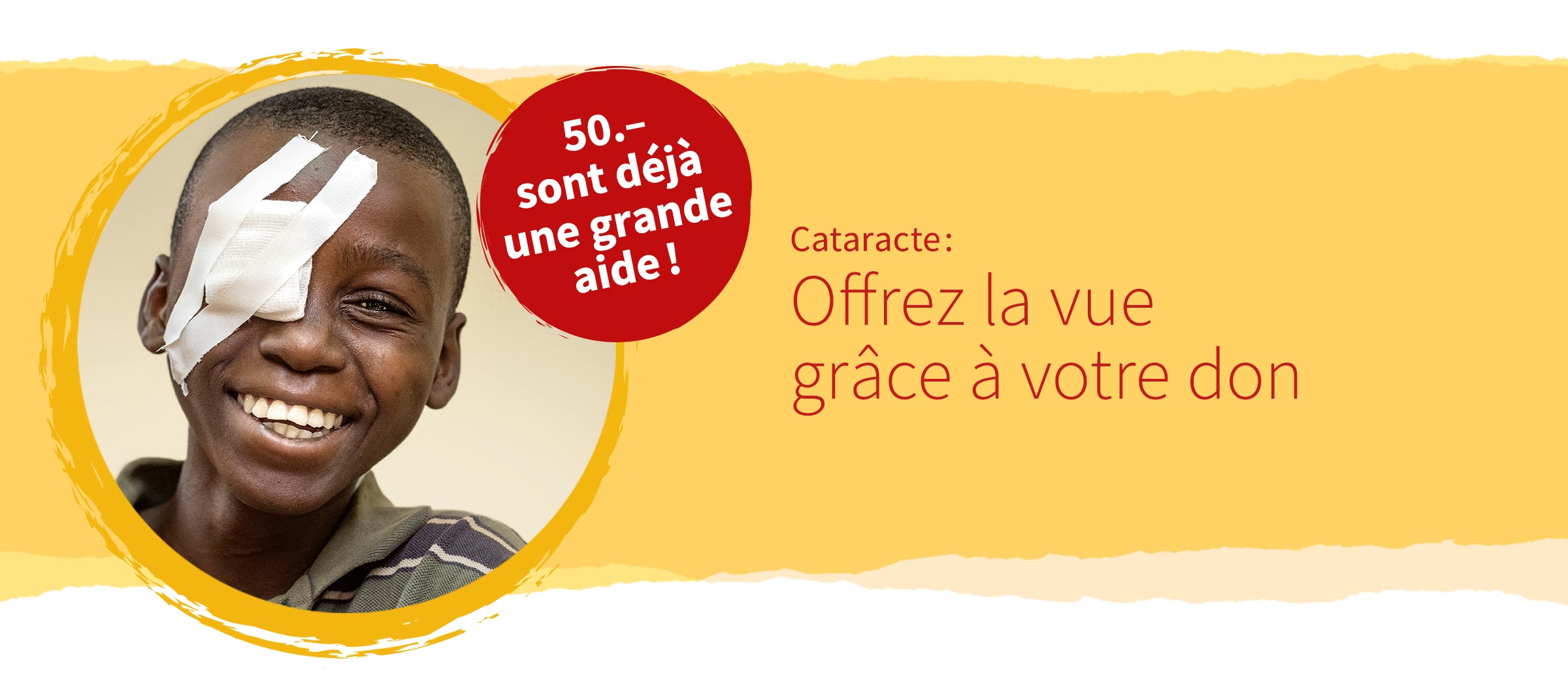 Cataracte: rendez la vue au moyen de votre don! Déjà 50 francs peuvent aider!»